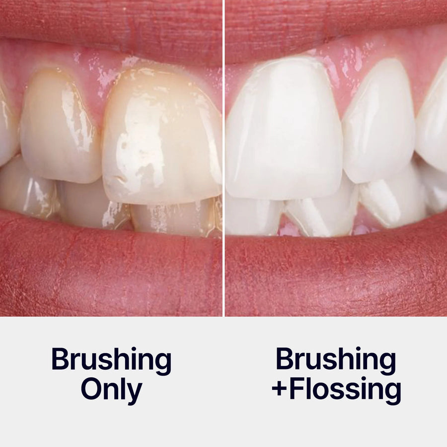 Helps Reach Between Teeth.